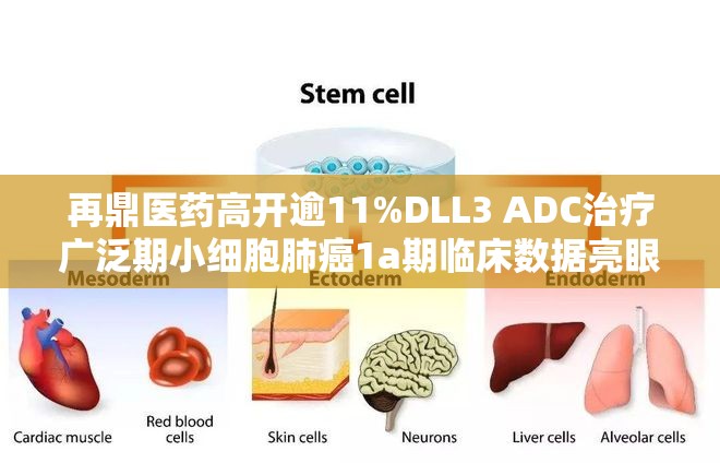 再鼎医药高开逾11%DLL3 ADC治疗广泛期小细胞肺癌1a期临床数据亮眼